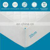 Hypoallergenic Smooth Soft 100% Cotton Waterproof Home Terry Towel Mattress Protector For Adults thumbnail-5