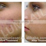 Photodynamic LED Skin Care LED Phototherapy Equipment for Sale thumbnail-6