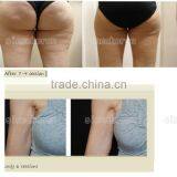 Kuma Shape Venashape Vaccum RF Massager Body Slimming Weight Loss Machine thumbnail-6