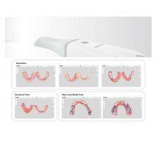 Intraoral Scanner thumbnail-4