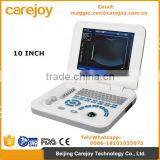 Carejoy Laptop Ultrasound Machine Ultrasound Scanner With Convex Probe RUS-9000F2 by CE ISO Approved thumbnail-1