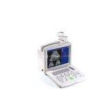 Portable Convex Ultrasound Scanner---CE Certified thumbnail-2