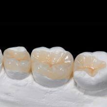 Full Service China Dental Lab Outsourcing of Metal Framework Cobalt Chromlum thumbnail-2