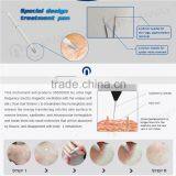 Professional Remove Varicose Veins Machine for Sale thumbnail-2