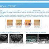 NEWS!!! 2015 HIFUShape Non-invasive Hifu Slimming/hifu Fat Reduction thumbnail-4