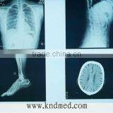 Agfa and Fuji Product in China thumbnail-1