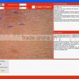 Professional Clinic Use Face Skin Analysis Equipment With FCC/CE Approval thumbnail-3
