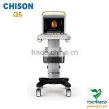 Medical Hospital 4d Portable Color Chison q5 Ultrasound Price
