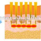 2015 New Product Medical CE Approval Microneedle Fractional RF for Skin Rejuvenation thumbnail-4