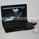 Full Digital Laptop Ultrasound Scanner RUS-9000F Optional Convex Probe Endocavity thumbnail-3