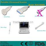 CE Approved Laptop/Portable Ultrasound Scanner With 3.5Mhz Multi-frequency Convex Probe RUS-9000B thumbnail-2