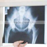 Thermal Dry Image,medical Devices Manufacturer,fuji Medical X-ray Film for Cancer Medical Equipment thumbnail-1