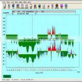 Hospital Instrument ABPM 50 Top Sale Ambulatory Blood Pressure Monitoring thumbnail-3