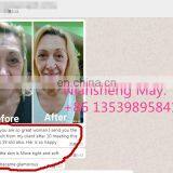 Double Screen 3 In1 Multi-function OPT IPL Laser Hair Removal Tattoo Removal Equipment Laser Hair Removal for Salon thumbnail-6