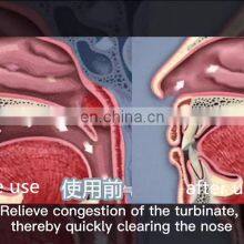 OEM ODM Supply Better Breath Relief Nasal Congestion Treat Rhinitis thumbnail-4