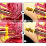 Non-invasive Vagin Tightening Equipment thumbnail-6