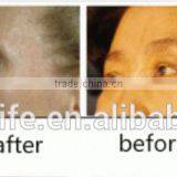 NL-M400 Premium Microcurrent Skin Tightening Skin Rejuvenation Mesotherapy Gun Beauty Device thumbnail-6