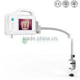 YSVV200 Guanghzou Hot Vein Illumination Device Price thumbnail-2