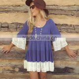 Zm50314b Europe Hot Sale Round Neck Ladies Clothes Loose Lace Short Dress thumbnail-1
