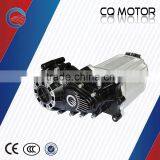 60V 5000W Big Power Electric Car Gearbox and Transaxle Gear Motor Kit thumbnail-1