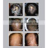 Meinas Bionutri Food (For Hair Regrowth) thumbnail-4