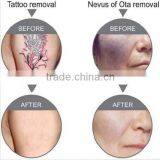 Best China Hot Sale!! Super Fast Color Touch Screen Medis Tattoo Removal Machine 10HZ thumbnail-6