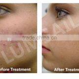 Colorful LED Phototherapy Light Therapy Facial Skin Spa Equipment thumbnail-2