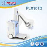 Mobile X-ray Unit PLX101D With Computed Radiography System thumbnail-1