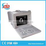 CRT display cheap portable ultrasound machine for wholesales