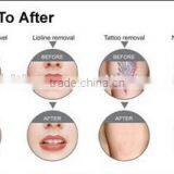 Painless Best Selling 3 in 1 Beauty Instrument 3 in 1 Machine Best Shr Ipl Machine Hair Removal thumbnail-3