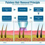 Pain-Free Hot Selling 808 Diode Chin & Lip Hair Removal Laser For Hair Removal thumbnail-4