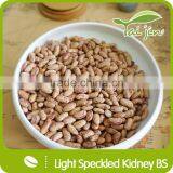 Edible Light Speckled Kidney Beans For Canning thumbnail-4