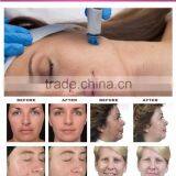 Peeling Machine For Face Relieve Skin Fatigue Water Oxygen Jet Peel Facial Beauty Jet Clear Facial Machine Improve Skin Texture Salon Face Steam Machine Wrinkle Removal Oxygenated Water Machine thumbnail-4