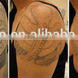 2015 MedApolo Top Performance Q-switch nd Yag Laser Tattoo Removal Laser thumbnail-2