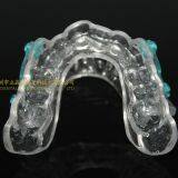 Anti-snoring Device, Dental Sportguard, Occlusal Splint, Laboratoire Dentaire, Dentallabor, Laboratorio Dental, Dental Laboratory, Shenzhen LJ Dental Lab China thumbnail-5