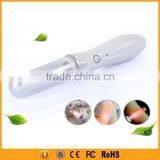 2015 Hot Selling Mini Facial Vibrator Ion Magic Wand