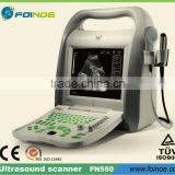 FN550 CE approved Full Digital B Mode portable portable ultrasound scanner