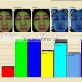 Magic Mirror 3D Skin Analyzer/ Best RGB+PL+UV Skin Analyzer thumbnail-3