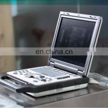 SV8 Portable Animals Ultrasound/ Veterinary Ultrasound Machine/vet Handheld Ultrasound Scanner thumbnail-5