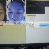 Big Discount!!!3d Scanner Dialysis Machine Price Dialysis Machine Price for Home Use thumbnail-4