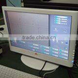 Beautiful Sperm Analysis System Analysis of Sperm Quality thumbnail-4