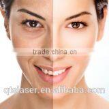 Ipl Laser + rf Hair Removal Set/acne Removal/wrinkle Removal thumbnail-4