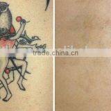 1064nm 532nm and Black Doll ND Yag Laser Tattoo Removal/Professional Laser Tattoo Removal With 500W Power thumbnail-6