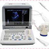 12-inch LCD Monitor Portable Ultrasound Scanner With Convex Linear Micro-convex Probe RUS 9000B thumbnail-1