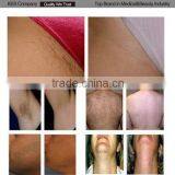 2015 Diode Laser 808nm Permanent Hair Removal Machine 500w Power Supply for Laser thumbnail-6