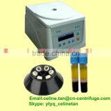 Small TD4C Hot Sale PRP Centrifuge Separating 10ml PRP Tube/kit Quality Choice thumbnail-1