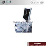 Super Quality Good Link Digital Non-Interlaced Portable Ultrasound Scanner 200D With Low Price thumbnail-6