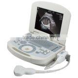 New Hot Selling Portable Ultrasound Scanner / Ultrasound Machine Suitable Clinic Community thumbnail-5