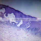 Factory Price Human Histological Oral Slides,pathological Prepared Slides,7101 Microscope Slides thumbnail-5