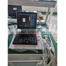 HC-A013C Factory Direct Portable 3D Color Doppler Ultrasound Machine 12 Inch LCD Display Laptop Ultrasound Diagnostic System thumbnail-3